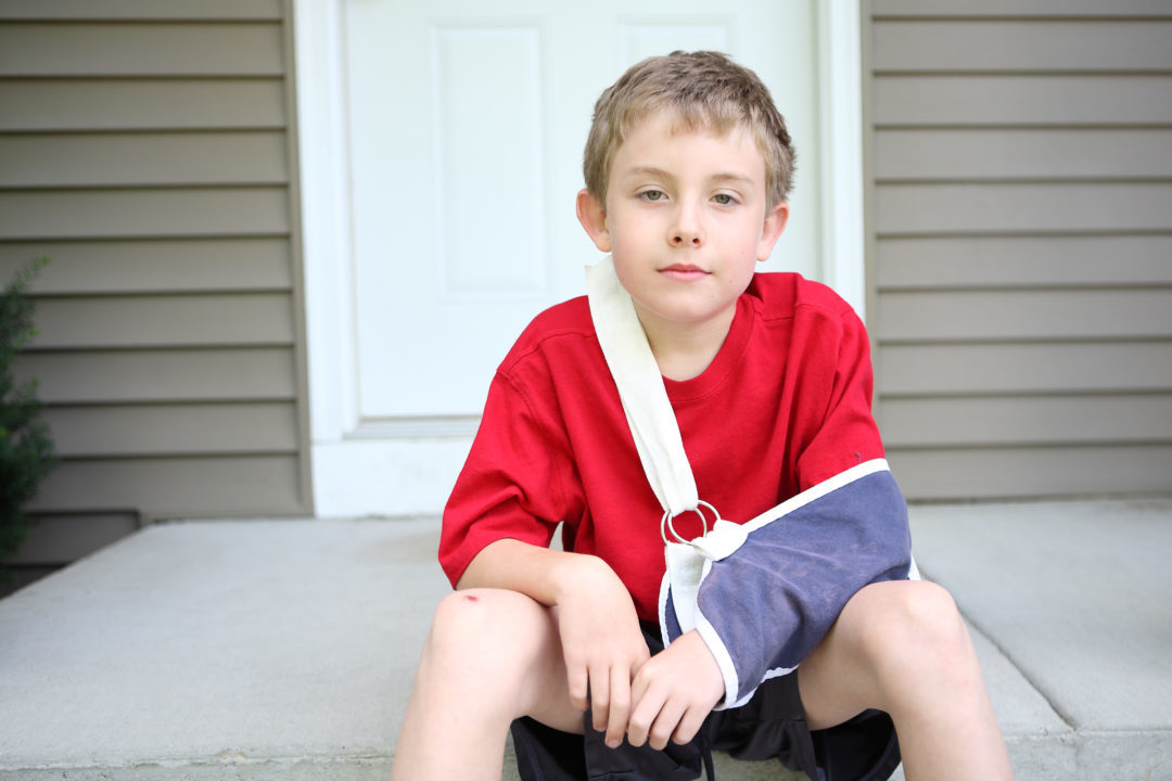 Children and Limb Injuries (suspected broken bones)