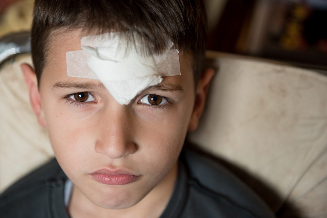 Photo of a child with a bandage on their head